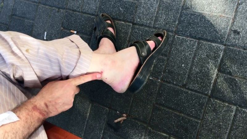 Beykoz’da komşusunu darp ettiği iddia edilen adam konuştu