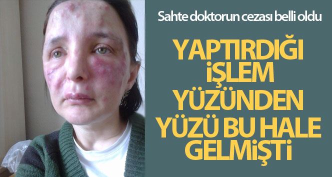 Yüzünde işlem yaptığı kadını tanınmaz hale getiren sahte doktor hakkında karar