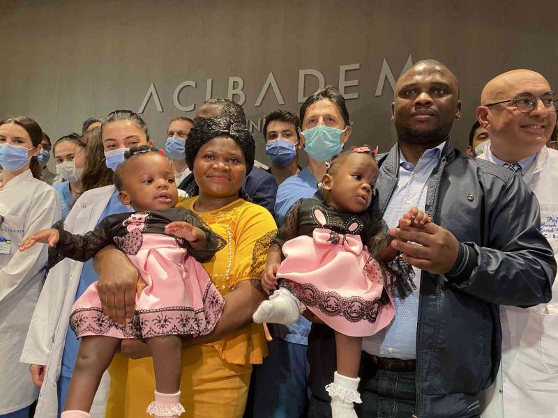 Kamerunlu yapışık ikizler Türkiye’de yeniden doğdu
