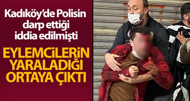 Polisin darp ettiği iddia edilen vatandaş kendisini eylemcilerin yaraladığını söyledi