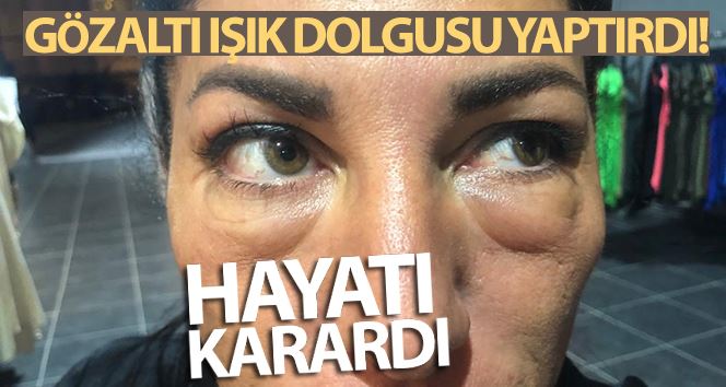 (Özel) Gözaltı ışık dolgusu yaptırdı, hayatı karardı