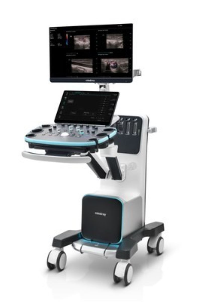 Mindray, Resona I9 ultrason sistemini piyasaya sürdü
