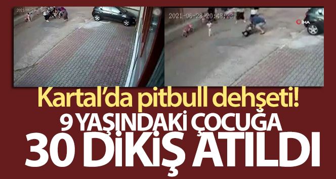 (Özel) Kartal’da 9 yaşındaki çocuğa pitbull’un saldırdığı anlar kamerada