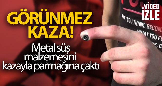 (ÖZEL) Sultangazi’de iş kazası geçiren gencin parmağına metal çaktı