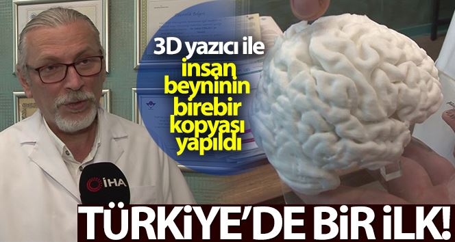 (Özel) Türkiye’de bir ilk: 3D yazıcı ile insan beyninin birebir kopyası yapıldı