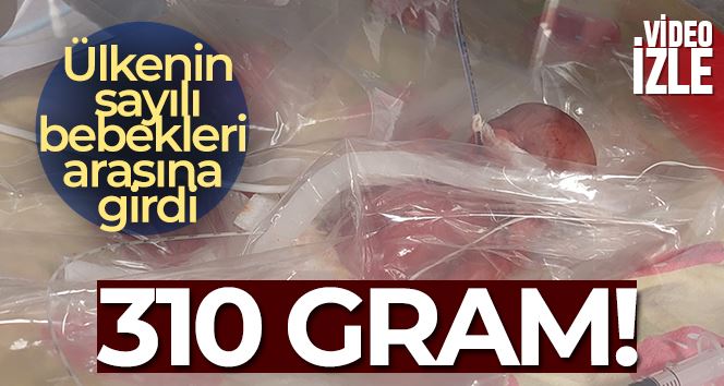 Tekirdağ’da 310 gramlık bebek doğdu