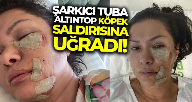 Ünlü şarkıcı Tuğba Altıntop köpek saldırısına uğradı