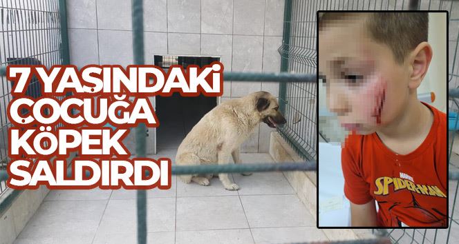 Bursa’da köpeğin saldırdığı çocuk yaralandı