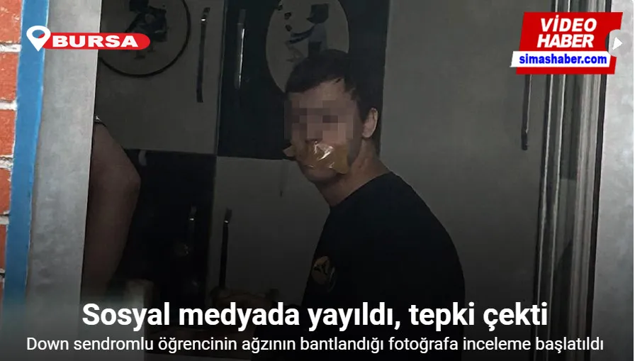 Down sendromlu öğrencinin ağzının bantlandığı fotoğrafa inceleme başlatıldı