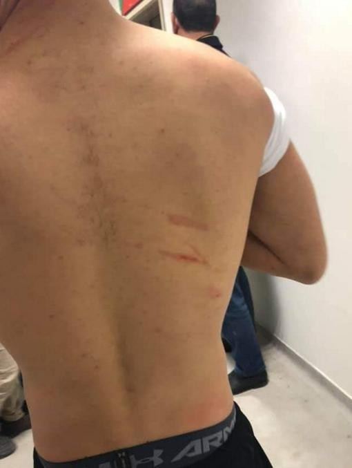 Amedspor - Sakaryaspor Maçında Şok İddia: Futbolcuları Jiletle Yaraladılar
